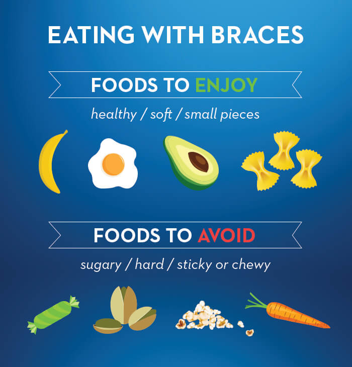 What foods can you eat when you first get braces What You Can And Can T Eat With Braces Oral B