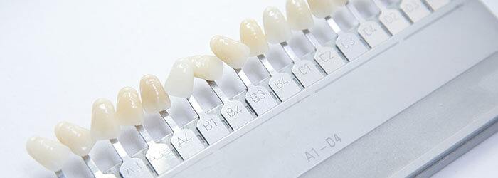 Dental Veneers What To Expect Oral B